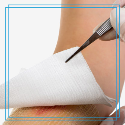 Dr-Paul-Silvers-cirujano-plastico-quito-manejo-de-heridas-y-tratamiento-en-quito