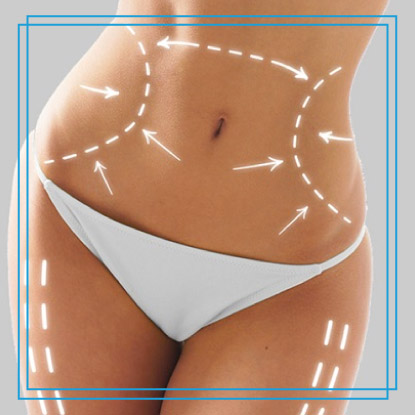 Dr-Paul-Silvers-cirujano-plastico-quito-recomendaciones-para-la-cirugia-de-lipoescultura