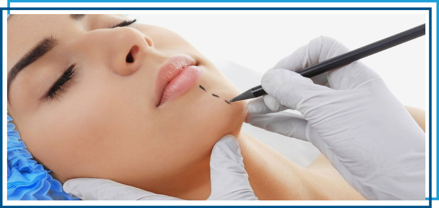 Dr-Paul-Silvers-cirujano-plastico-quito-tratamiento-de-mentoplastia-en-quito