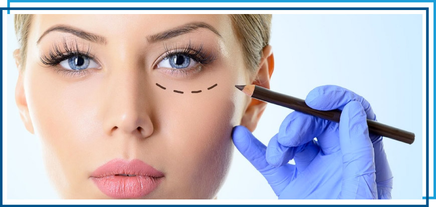 Dr-Paul-Silvers-cirujano-plastico-quito-procedimientos-de-blefaroplastia-en-quito