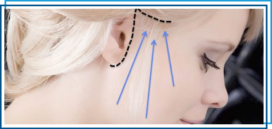 Dr-Paul-Silvers-cirujano plastico-quito-procedimientos-de-minilifting en quito